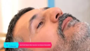 Sağlık Mutluluk DemektirAkupunktur Hangi Hastalıklarda Kullanılır Akupunktur Faydaları Nedir?