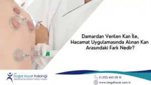 Sağlık Mutluluk DemektirHacamat Tedavisi Faydaları - Hicri Hacamat Günleri