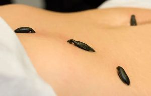 Sülüğün Biyoaktif Salgı İçeriği