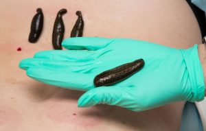 Sülüğün Tıbbi Etkileri