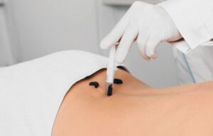 Sülük Hangi Durumlarda ve Hangi Bölgelere Uygulanmaz?