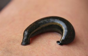 Sülük Tedavisinin Faydaları Nelerdir?