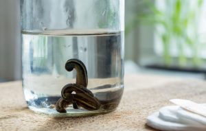 Tıbbi Sülük Tedavisi