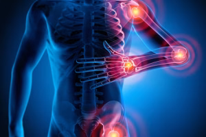 Eklem Romatizmaları (Ankilozan Spondilit – Gut – Romatoid Artrit)