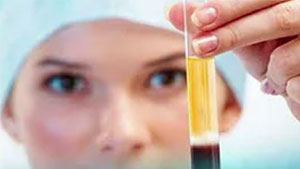 Sağlık Mutluluk DemektirPRP ( Platelet Rich Plazma ) Tedavisi