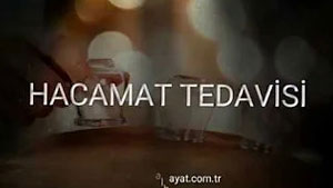 Sağlık Mutluluk DemektirHacamat Tedavisi