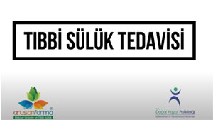 Sağlık Mutluluk DemektirTıbbi Sülük Tedavisi