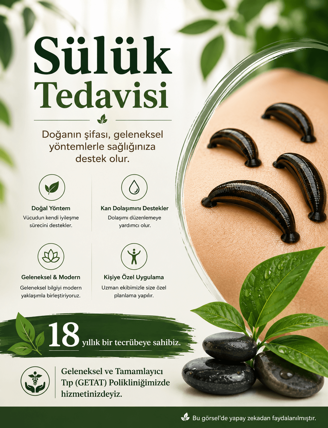 Sülük Tedavisi